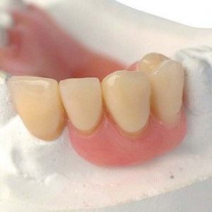 partial-dentures (1)