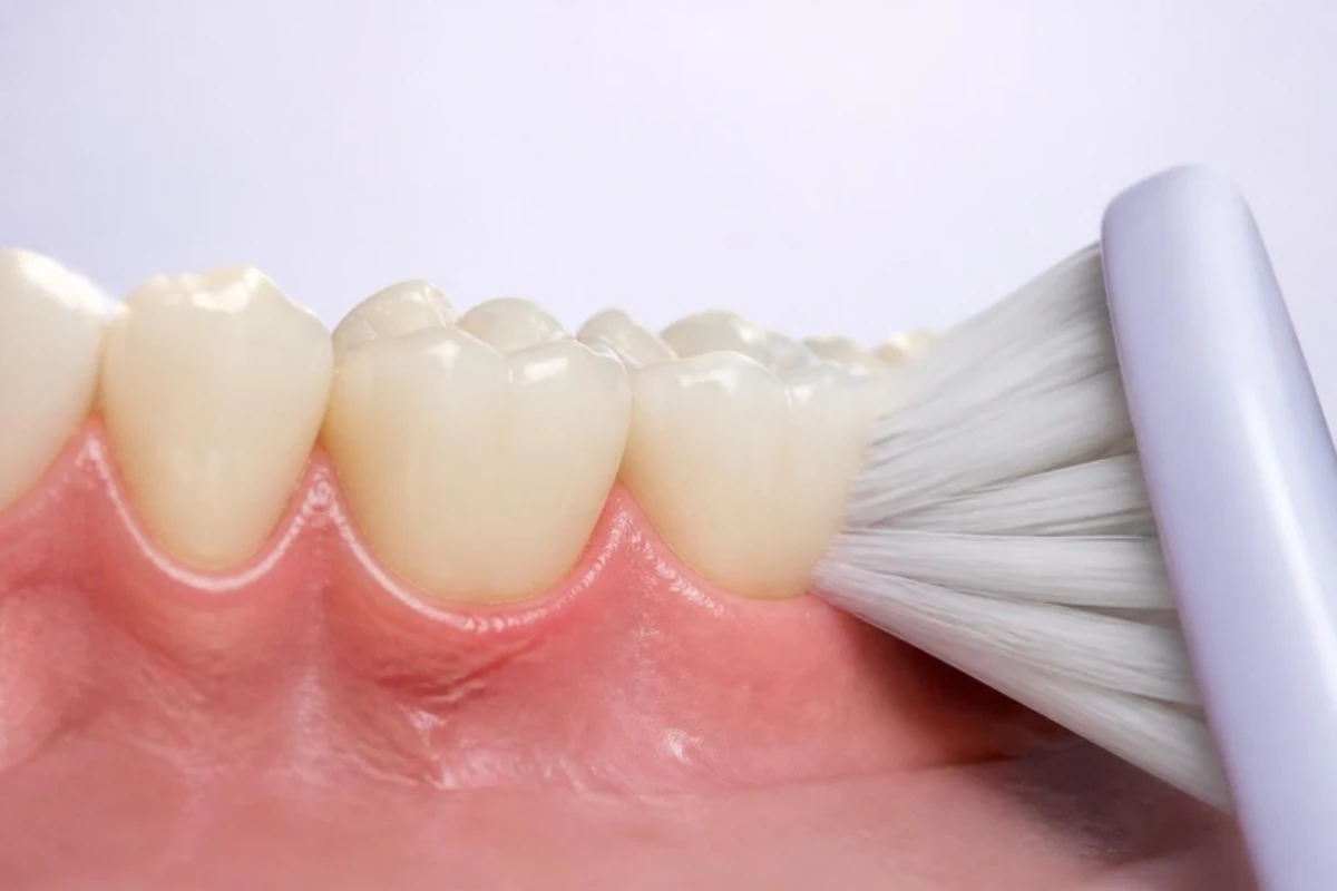 3D illustration of the lower teeth seen from the cheek side, with a soft toothbrush whose bristles tilt toward the gum so the tips rest on the gum line