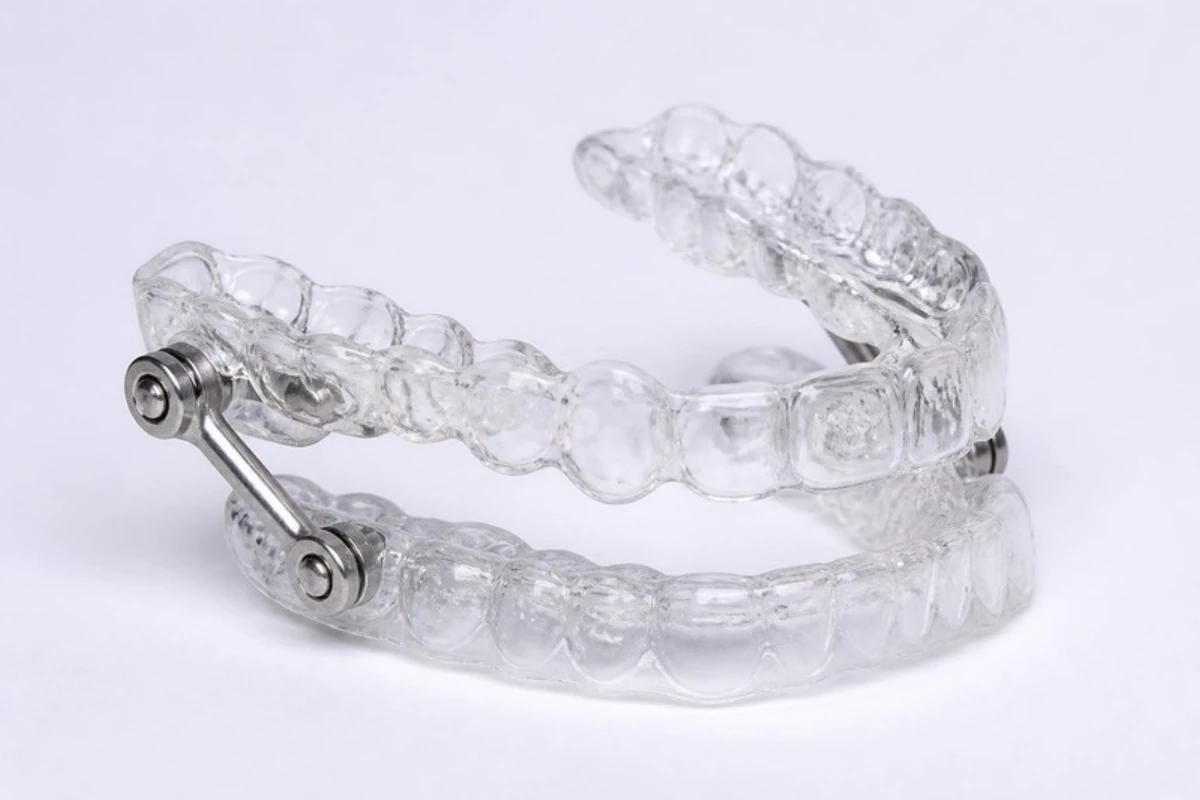 3D illustration of a two-piece mandibular advancement device: clear upper and lower trays joined on each side by metal connector arms