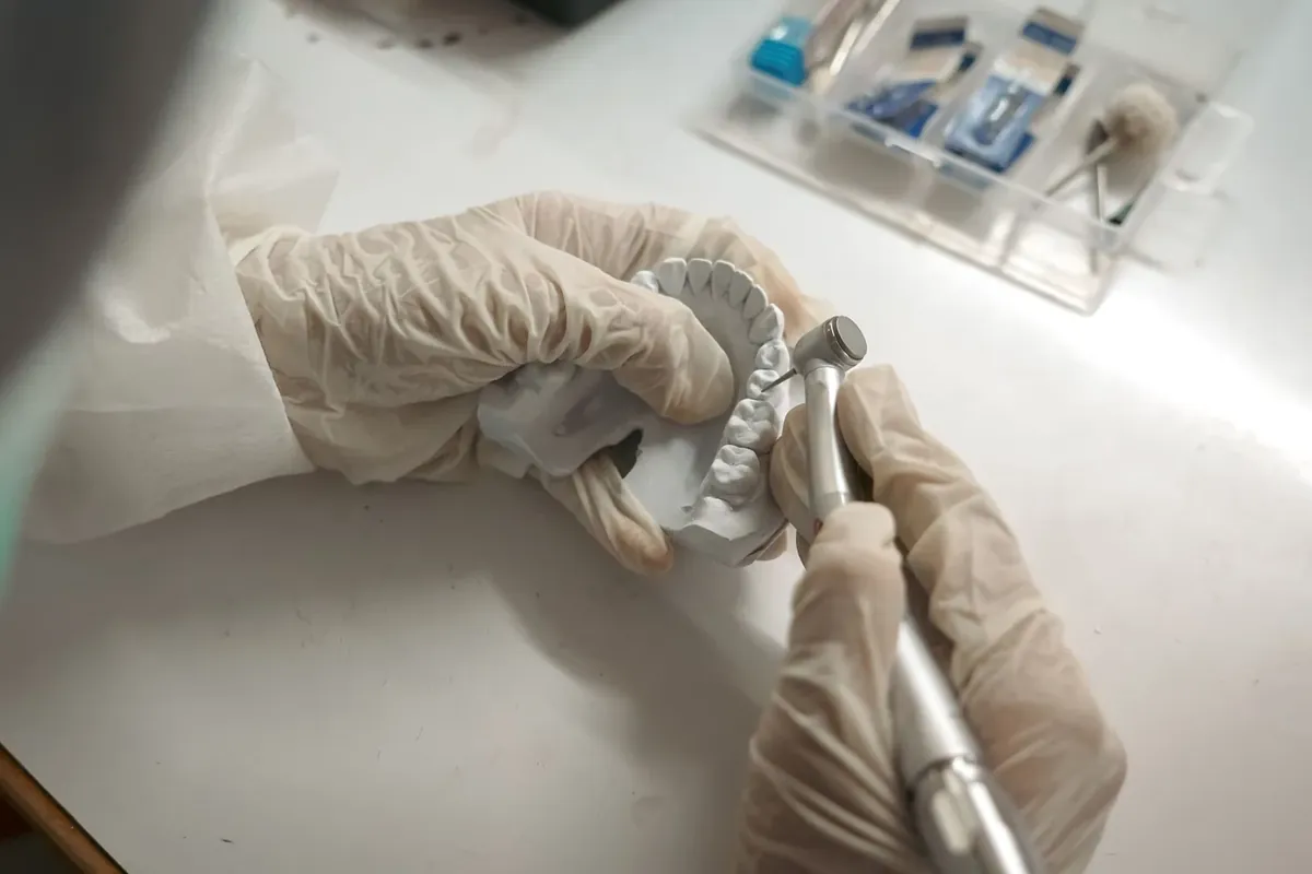 A dental technician finishing a metal partial denture framework on a model in the lab