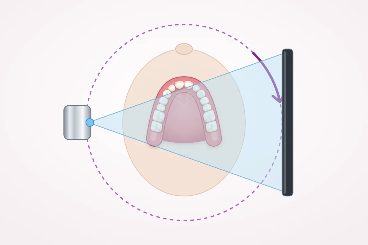 Illustration of a CBCT scan seen from above: a cone-shaped X-ray beam passes through the head to a detector while the machine turns once around the head