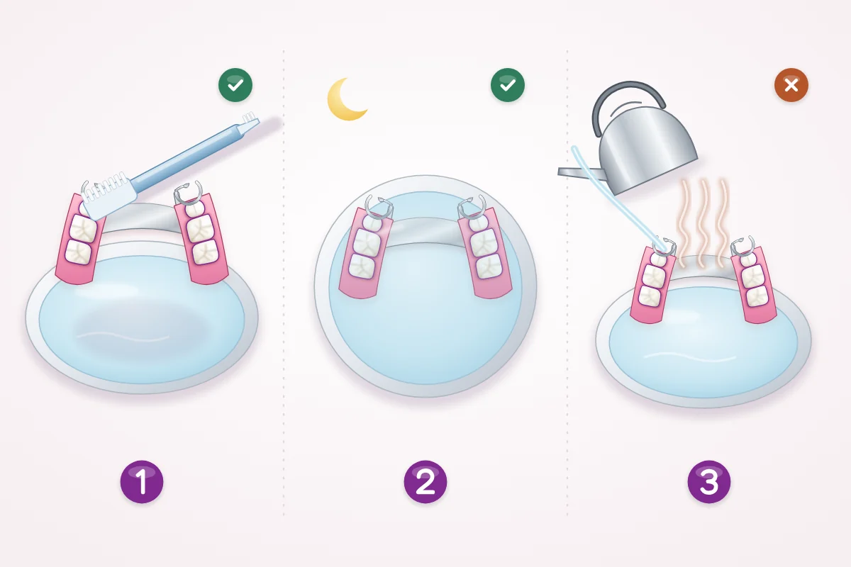 Illustration of partial denture care: brushing it with a denture brush over a basin of water, keeping it in water overnight, and no hot water