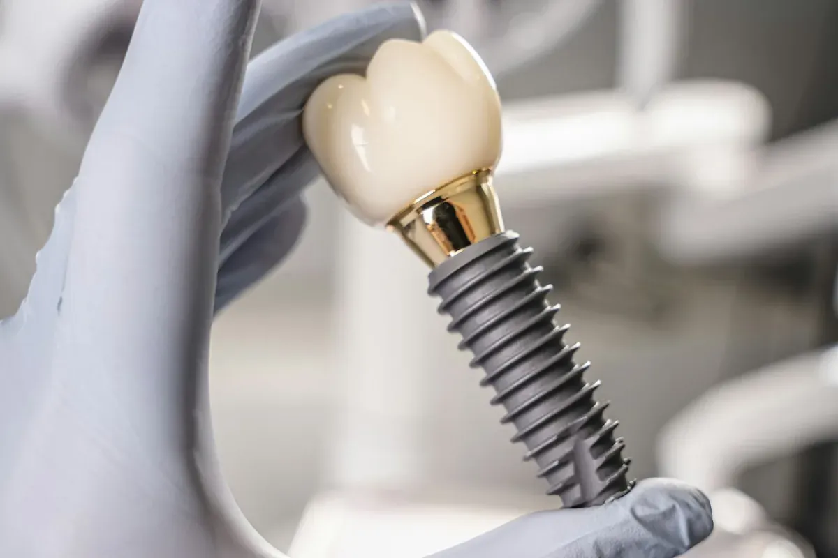 A gloved hand holding a single dental implant model with its abutment and crown
