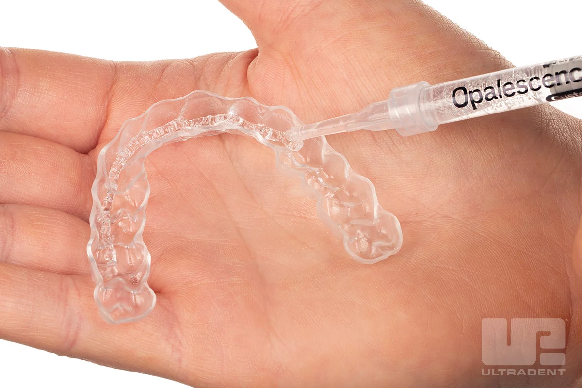 Official Ultradent photo of a clear custom whitening tray in the palm of a hand, with Opalescence gel being applied from a syringe