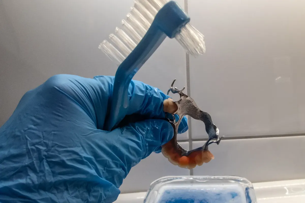 A gloved hand holding a metal-framework partial denture and a denture brush above a dish of cleaning solution